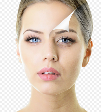 Chemical peel Skin care Exfoliation Facial rejuvenation - makeup 