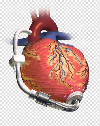 Ventricular assist device Heart transplantation Artificial heart Ventricle, Left Ventricle transparent background PNG clipart