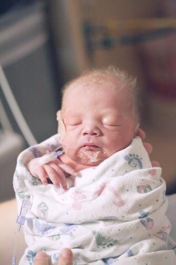 Premature newborn baby born at 34 weeks gestation in the neonatal intensive care unit.